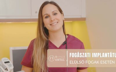 Fogászati implantátumok frontfogak esetében